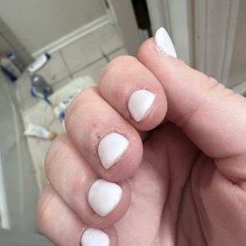 312 Nails & Spa - Nail glue stuck to skin - Nail Salons Near Me - Wheeling, Illinois