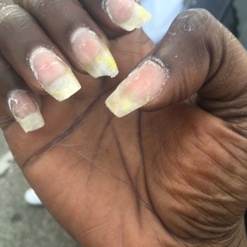 Ambiance Nail Spa - After removing the SnS and acrylic nails. The color bled threw on my real nail. - Nail Salons Near Me - Cincinnati, Ohio Ambiance Nail Spa - After removing the SnS and acrylic nails. The color bled threw on my real nail. - Nail Salons Near Me - Cincinnati, Ohio