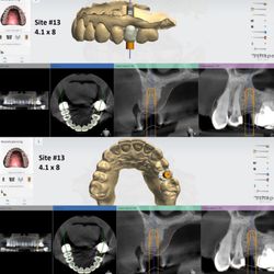 Jason N Monempour, DDS - Holistic Smiles