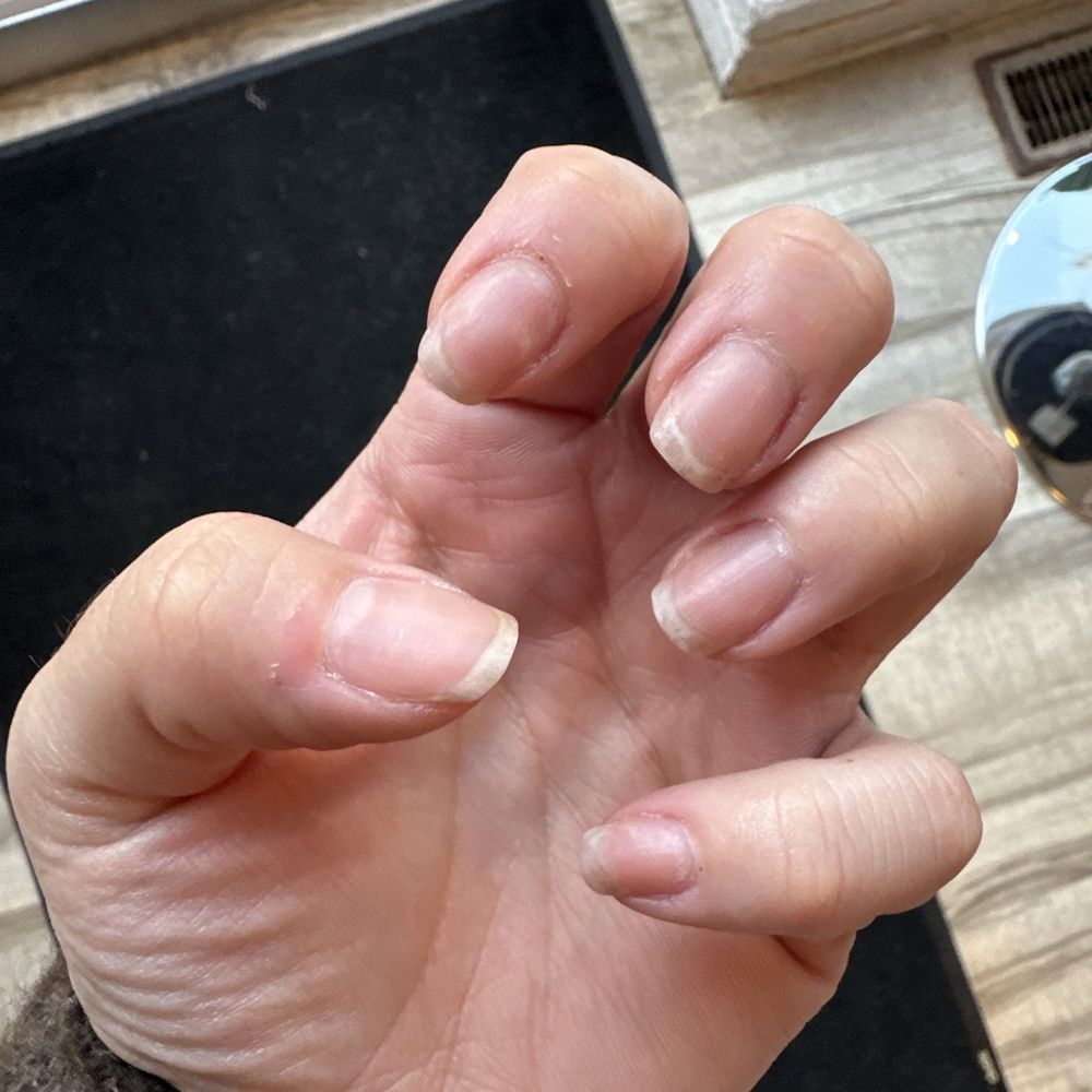 ESSENTIAL NAIL BAR - Had to file and cut my own nails, 3 days later - Nail Salons Near Me - Birmingham, Michigan ESSENTIAL NAIL BAR - Had to file and cut my own nails, 3 days later - Nail Salons Near Me - Birmingham, Michigan