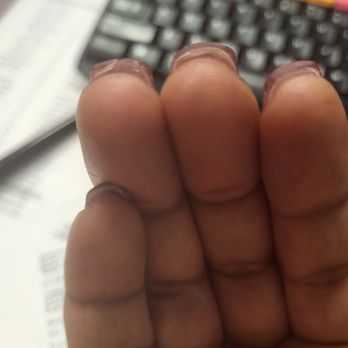 Fleur De Nails & Spa - Already broken acrylic under nail. Polish is holding it together. - Nail Salons Near Me - Harahan, Louisiana Fleur De Nails & Spa - Already broken acrylic under nail. Polish is holding it together. - Nail Salons Near Me - Harahan, Louisiana