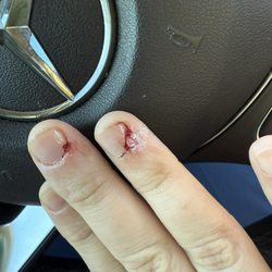 ENails Salon - This was how I left after getting a manicure. She kept cutting my skin and then attempted to use super glue and then dab with cotton.