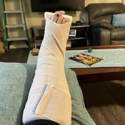 Mercy Hospital of Folsom - Splint