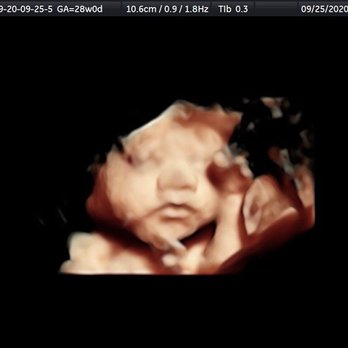 4D Miracles - 5D - Ultrasound Imaging Centers Near Me - Fremont, California 4D Miracles - 5D - Ultrasound Imaging Centers Near Me - Fremont, California