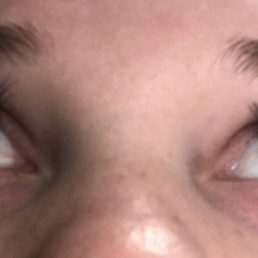 Day 3 (left side has about 5 lashes that I have noticed fall out and gaps from it)
