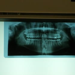 Christopher J. Saal, DDS MD - Sample work.