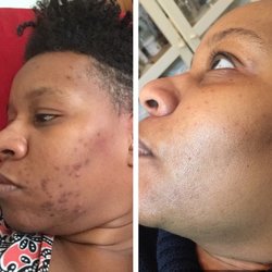Advanced Skin Care Solutions