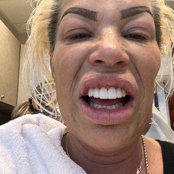 Me crying she gave me these DONKEY TEETH nothing like my natural teeth she WACKED OFF