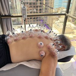 Inner Chi Hawai'i - Cupping