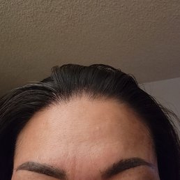 Eyebrows healed after 6 days. Eyebrows healed after 6 days.