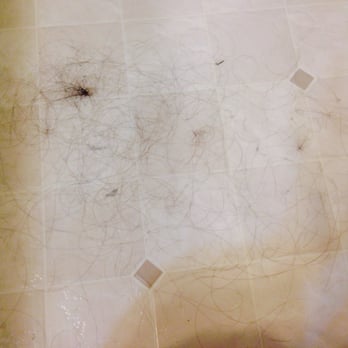 Regenix - Lost half of my hair after using Regenix product! Not worth it - Hair Loss Centers Near Me - Culver City, California