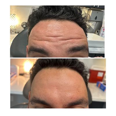 TOP 10 BEST Glutathione Injection in Henderson, NV - Updated 2026 - Quality  & Affordability - Yelp