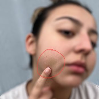 Cypress Plaza Dental Group - Bruising - General Dentistry Near Me - Cypress, California Cypress Plaza Dental Group - Bruising - General Dentistry Near Me - Cypress, California