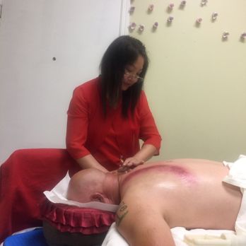 Family Massage - Thank you Joanne for cupping experience :) - Massage Near Me - Lincoln, California Family Massage - Thank you Joanne for cupping experience :) - Massage Near Me - Lincoln, California