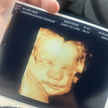 4D Miracles - Ultrasound Imaging Centers Near Me - Fremont, California 4D Miracles - Ultrasound Imaging Centers Near Me - Fremont, California