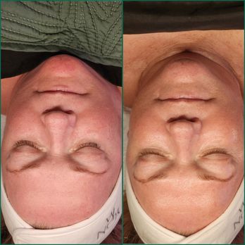 Kara Likes Esthetics - Skin Care Near Me - Southlake, Texas Kara Likes Esthetics - Skin Care Near Me - Southlake, Texas