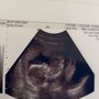 Photo of Baby View