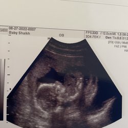 Baby View - 2d ultrasound 17 weeks