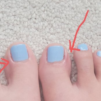 Q Nails and Spa - Swollen cuticles!!! - Nail Salons Near Me - Sandy Springs, Georgia