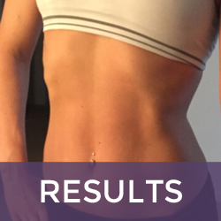 Sculptor Body Contouring