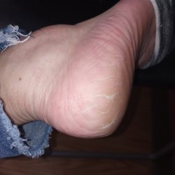 Top Nails - $95 for feet and nails for them to look like this never again