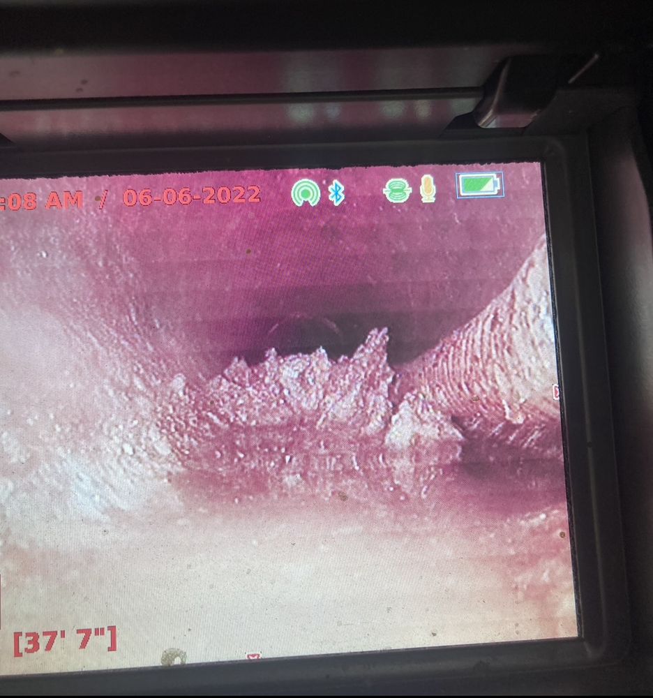 Slide of Drain Pains