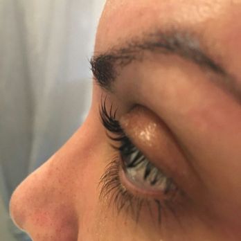 Aesthetics By Cherrié - After treatment - Skin Care Near Me - Fair Oaks, California Aesthetics By Cherrié - After treatment - Skin Care Near Me - Fair Oaks, California