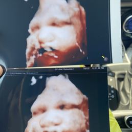 34 weeks face photo ultrasound