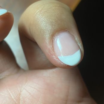 Elite Nails & Spa - The skin surrounding my nail is tender and raw and still stings - Nail Salons Near Me - Downey, California Elite Nails & Spa - The skin surrounding my nail is tender and raw and still stings - Nail Salons Near Me - Downey, California