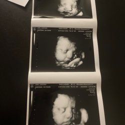 Houston Babies 4d Ultrasound