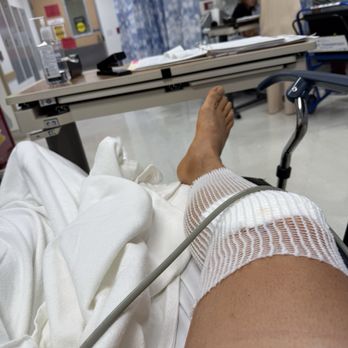 Community Surgery Center - After knee surgery - Medical Centers Near Me - Glendale, California