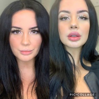 Ocean Plastic Surgery Center - Cosmetic Surgeons Near Me - Los Alamitos, California Ocean Plastic Surgery Center - Cosmetic Surgeons Near Me - Los Alamitos, California