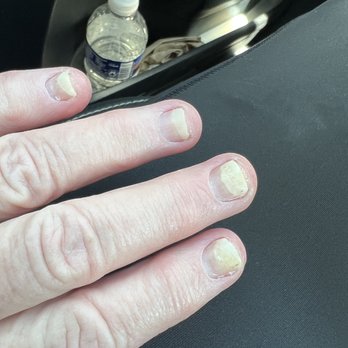 Spa One Nails - Nails are no longer attached to the nail beds!! - Nail Salons Near Me - Dunkirk, Maryland