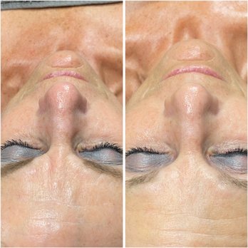 Beautify - Glycolic Chemical Peel, Fit & Firm Mask - Waxing Near Me - Mount Pleasant, South Carolina