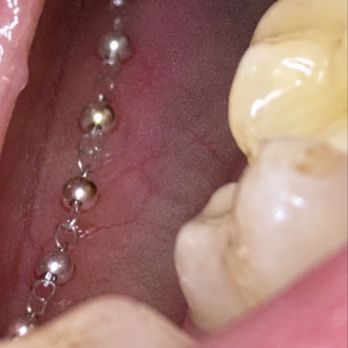 Louis Pannullo DDS MS - Just a chain that was out in without my knowledge and denied he did so - Oral Surgeons Near Me - Williston Park, New York Louis Pannullo DDS MS - Just a chain that was out in without my knowledge and denied he did so - Oral Surgeons Near Me - Williston Park, New York