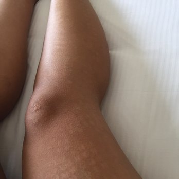 Dermabare - Laser Hair Removal Near Me - Laguna Niguel, California Dermabare - Laser Hair Removal Near Me - Laguna Niguel, California
