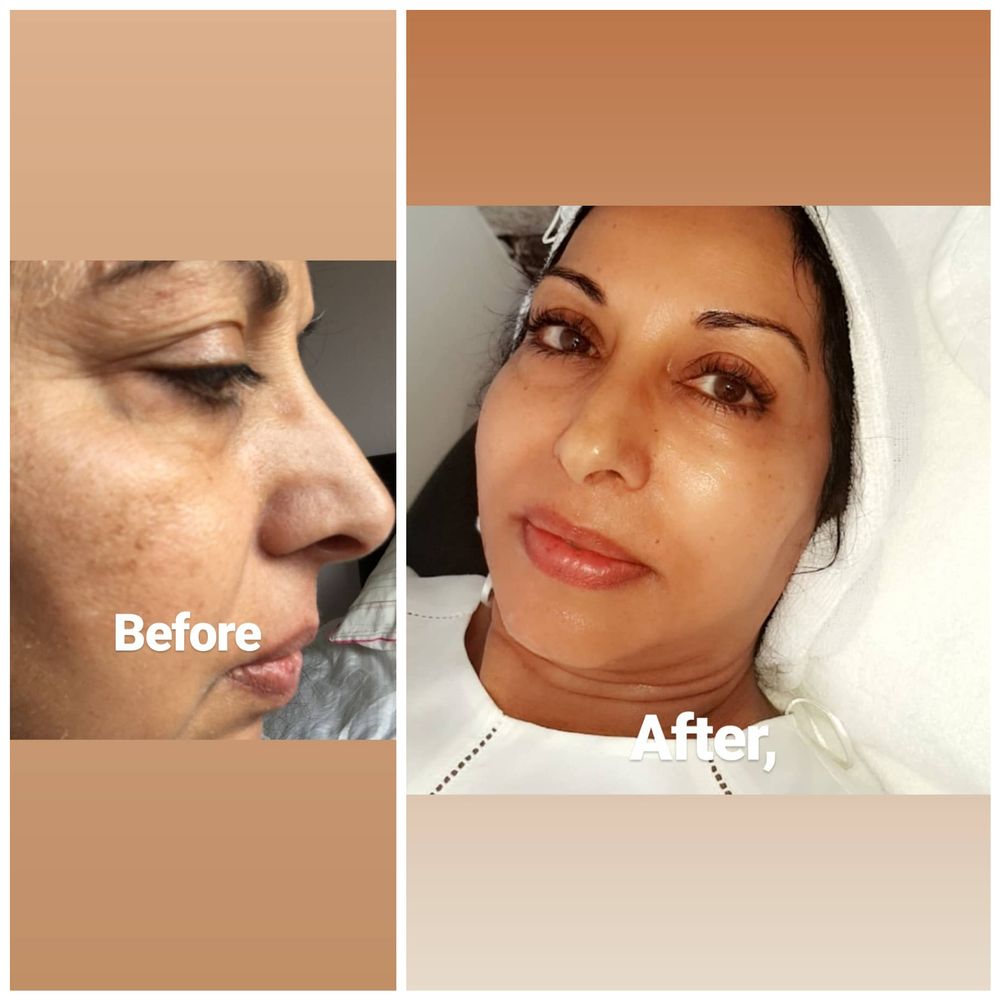 BAYSIDE BEAUTY CLINIC Laser Hair Removal Botany Bay Road, Stokeon