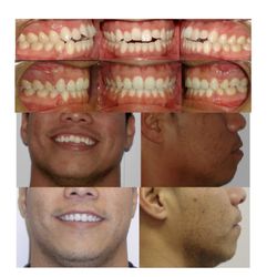 Icare Orthodontics