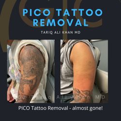 GentleCare Laser Aesthetics