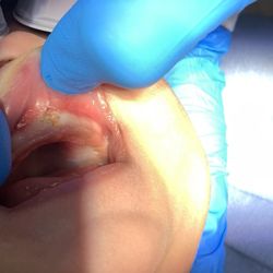 James T Jesse, DDS - After