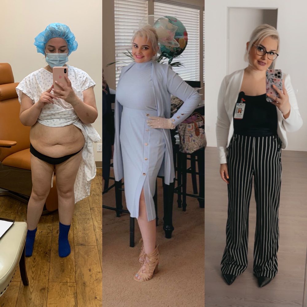 Iconic Plastic Surgery - Before and After - Cosmetic Surgeons Near Me - Carlsbad, California Iconic Plastic Surgery - Before and After - Cosmetic Surgeons Near Me - Carlsbad, California