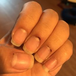 I had to remove the polish because it was chipping on day 2