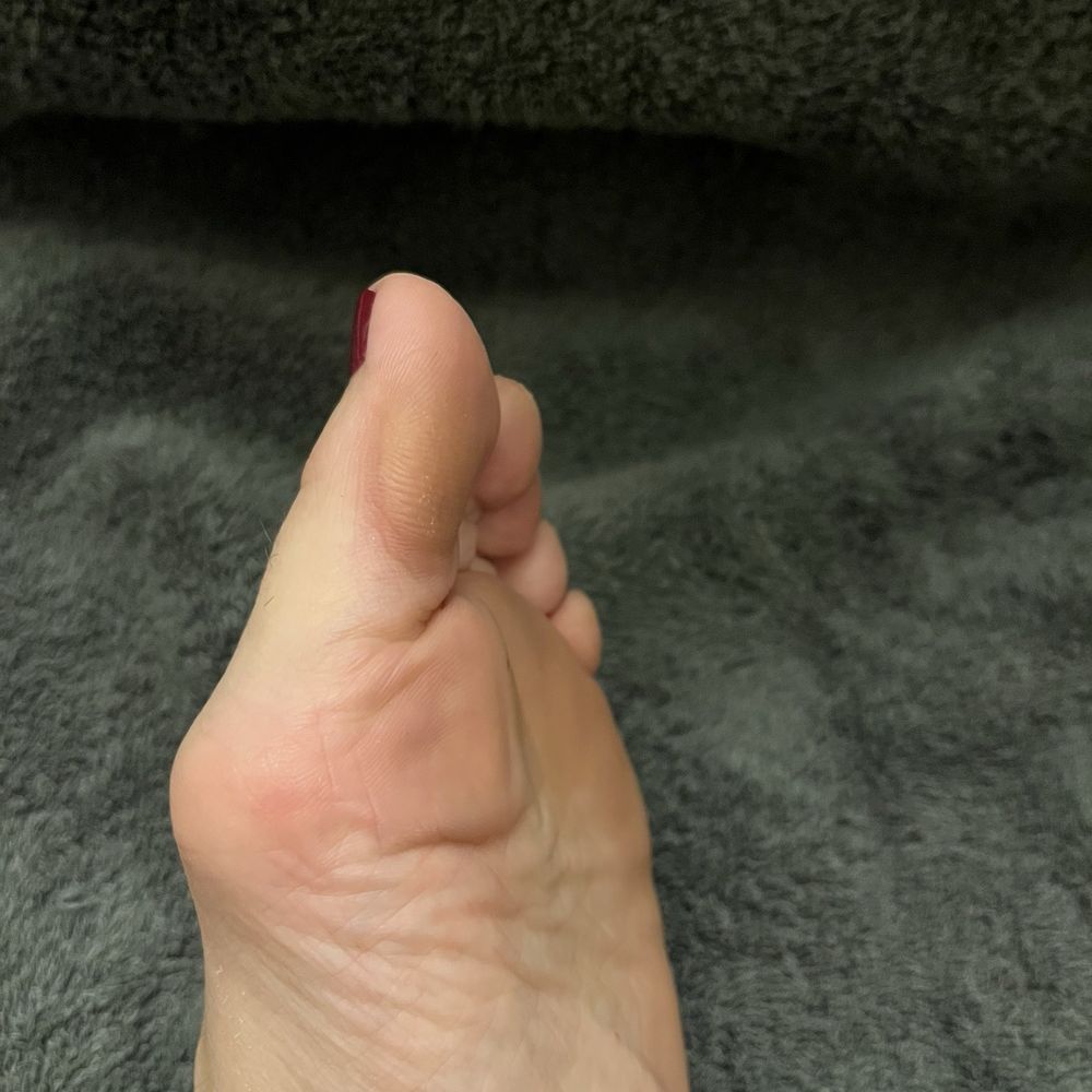 Top Nails Salon & Spa - For $35, should I still have such a visible callous on my big toe? - Nail Salons Near Me - Cincinnati, Ohio Top Nails Salon & Spa - For $35, should I still have such a visible callous on my big toe? - Nail Salons Near Me - Cincinnati, Ohio