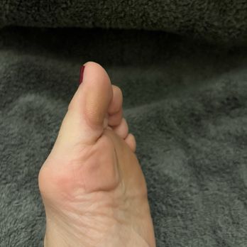 Top Nails Salon & Spa - For $35, should I still have such a visible callous on my big toe? - Nail Salons Near Me - Cincinnati, Ohio Top Nails Salon & Spa - For $35, should I still have such a visible callous on my big toe? - Nail Salons Near Me - Cincinnati, Ohio