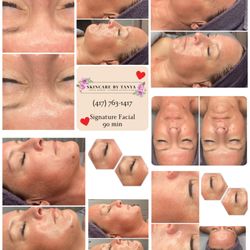 Skincare By Tanya - 90-min Signature Facial: reduced redness, softened eye & mouth lines, brighter, glowing complexion. #SkincareByTanya #417facials