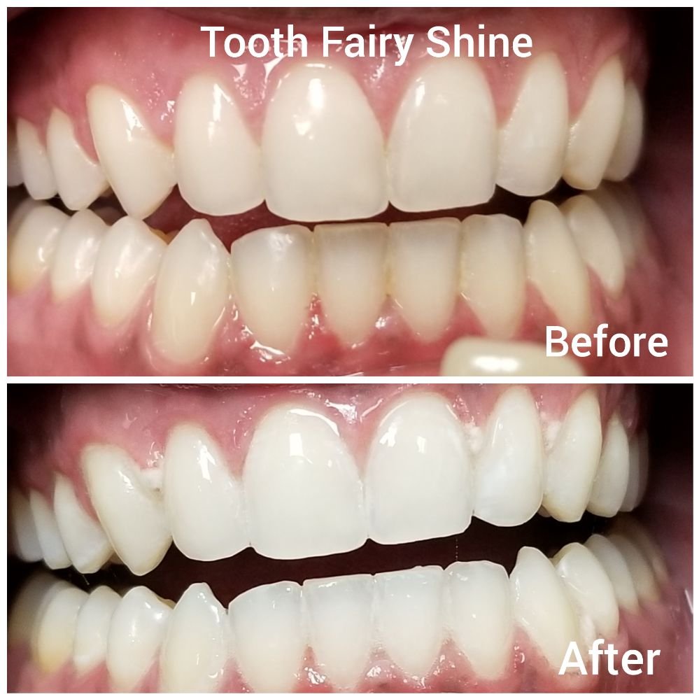 Tooth Fairy Shine Logo