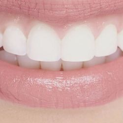 Four Corners Dental Group - Four Corners Dental Fairbanks, AK Family Dentist