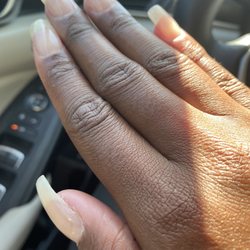 Fancy Nails - Uneven acrylic overlay on my REAL nails. The middle finger cuticle cut and bleeding.