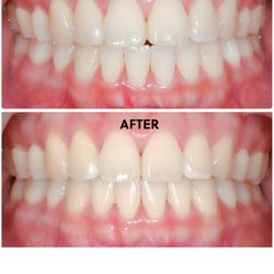 One Smile Orthodontics - Attention to detail. Don't settle for mediocracy.