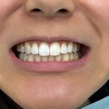 Diamond Bar Dental Studio - Cosmetic Dentists Near Me - Diamond Bar, California